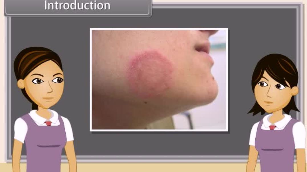 Class 12 th English Medium Biology Animated video Of Human Health and Disease-I